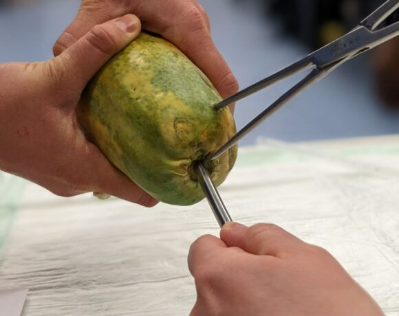 Zu sehen ist ein Close up von einer Papaya, in die ein Dilatatoor eingeführt wird und die Papaya oberhalb des Eintrittslochs mit einer Klemme fixiert wird.